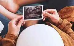 2026年单身群体在云南大学附属医院做试管的条件与步骤一览