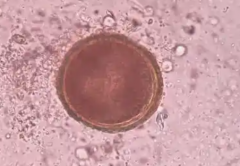 2026年马来西亚三代试管婴儿包成功是真的吗?操作流程与关键注意事项